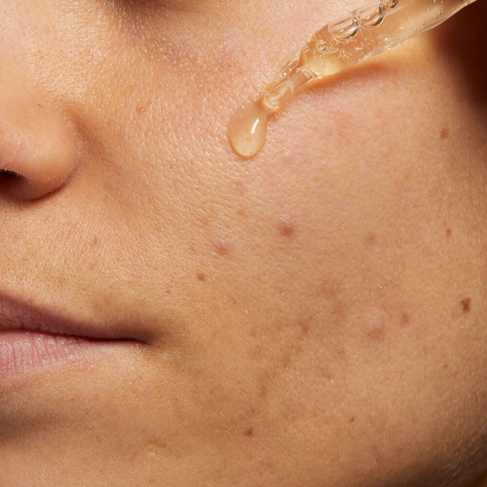 Pure Mc Pure Serum Gallery