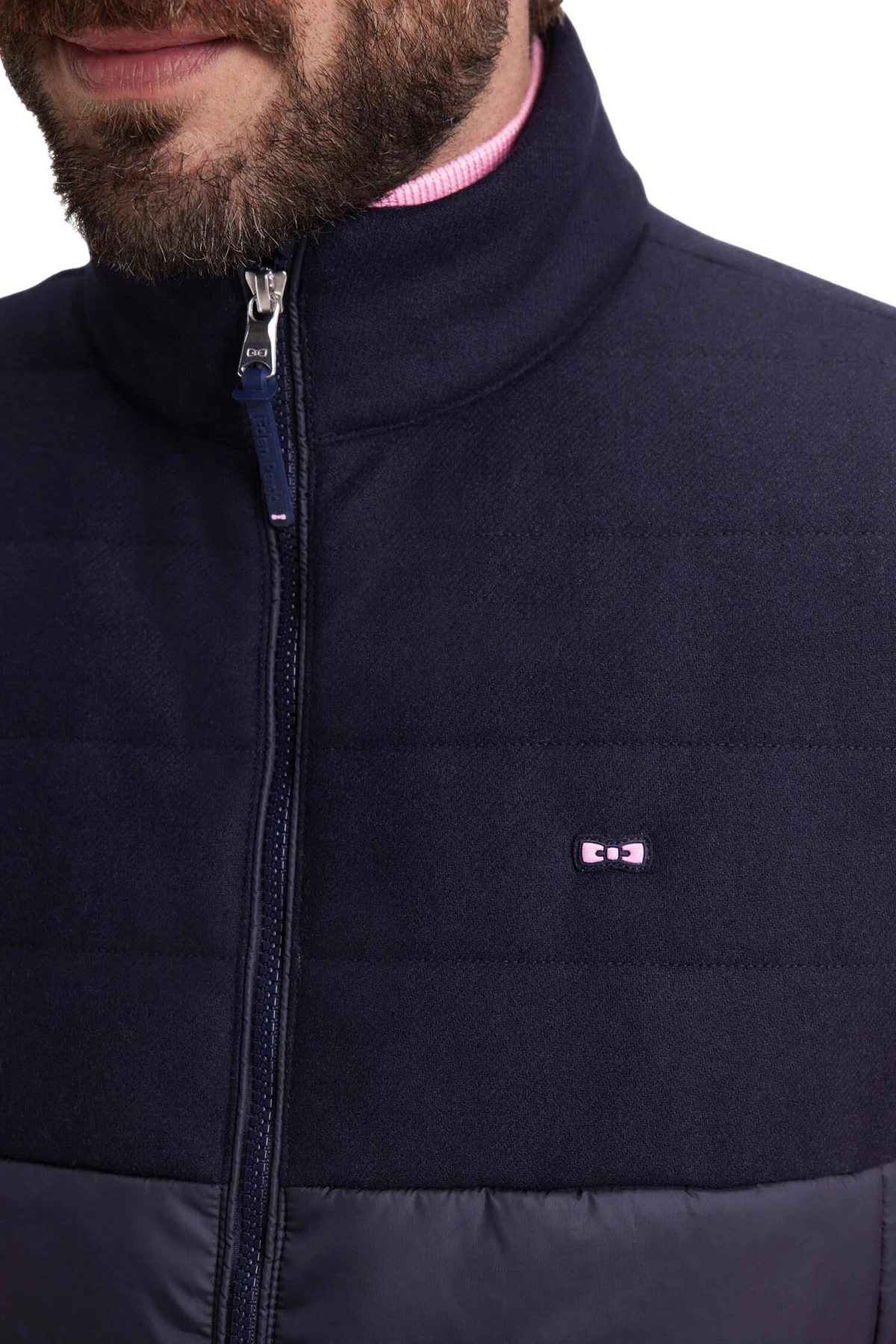 Sleeveless Double-material Down Jacket Gallery