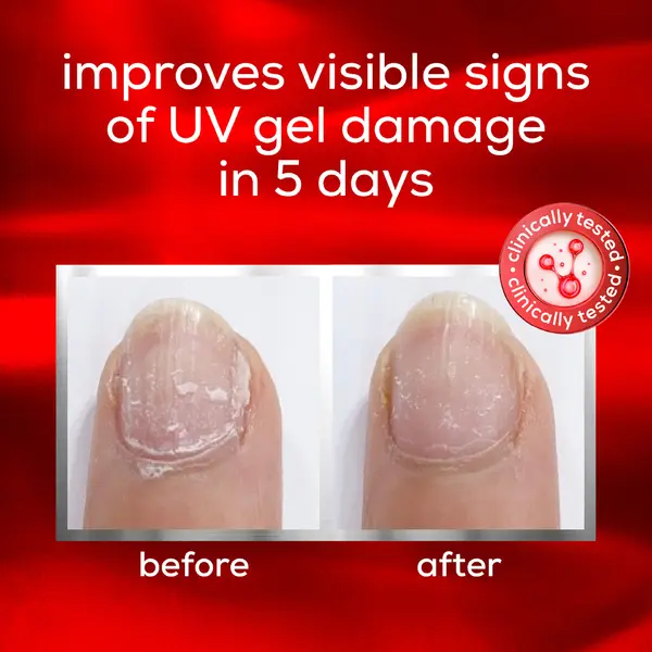 Essie Nail Care - To The Rescue UV Gel Damage  3 Image