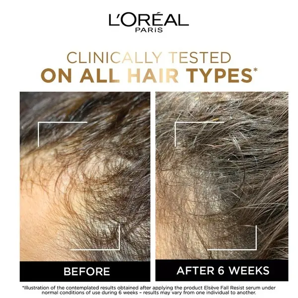 L’Oréal Paris Elvive Fall Resist Anti Hair-Fall Serum  4 Image