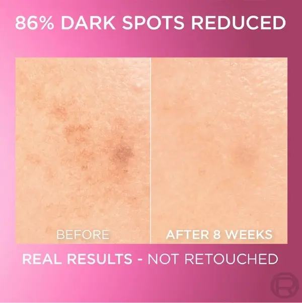 L’Oréal Paris Glycolic Bright Serum with 8% [Melasyl  + Glycolic Acid + Niacinamide] face serum for Dark Spots & Brightening 30ml 3 Image