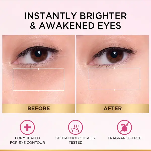 L'Oréal Paris Glycolic [3% Glycolic Acid  + Vitamin CG + Niacinamide] Eye Serum For Dark ircles, Brighten Eyes 20ml. 3 Image